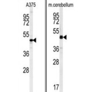 C10orf46 Antibody