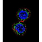 Checkpoint Kinase 2 (CHEK2) Antibody