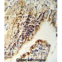 Checkpoint Kinase 2 (CHEK2) Antibody