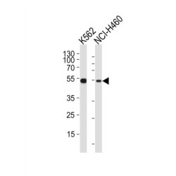 Checkpoint Kinase 2 (CHEK2) Antibody