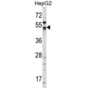 Carbonic Anhydrase 9 (CA9) Antibody