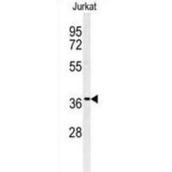 G Protein Beta 1 (GNB1) Antibody