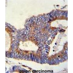 Endoplasmic Reticulum Chaperone BiP (HSPA5) Antibody