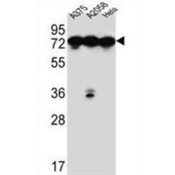 Endoplasmic Reticulum Chaperone BiP (HSPA5) Antibody