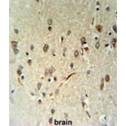 LIM Domain Containing 2 (LIMD2) Antibody