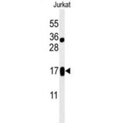 LIM Domain Containing 2 (LIMD2) Antibody