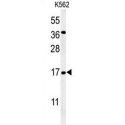 N(Alpha)-Acetyltransferase 50, NatE Catalytic Subunit (NAT13) Antibody