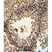 PHD Finger Protein 13 (PHF13) Antibody