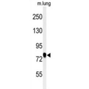 Semaphorin 3C (SEMA3C) Antibody