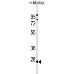 Tumor Protein P63-Regulated Gene 1-Like Protein (TPRGL) Antibody