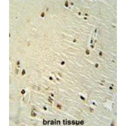 X-Ray Repair Cross Complementing 6 (XRCC6) Antibody