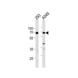 X-Ray Repair Cross Complementing 6 (XRCC6) Antibody