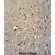 Poly(A) RNA Polymerase GLD2 (GLD2) Antibody