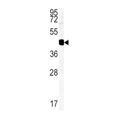 Estradiol 17-Beta-Dehydrogenase 2 (HSD17B2) Antibody