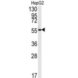 Fatty Acid Amide Hydrolase 2 (FAAH2) Antibody