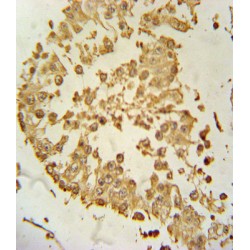 Probable Palmitoyltransferase ZDHHC21 (ZDHHC21) Antibody