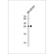 Western blot analysis of lysate from SH-SY5Y cell line, using ZDHHC21 Antibody (N-term). ZDHHC21 Antibody was diluted at 1:1000. A goat anti-rabbit IgG H&L (HRP) at 1:10000 dilution was used as the secondary antibody. Lysate at 20ug.