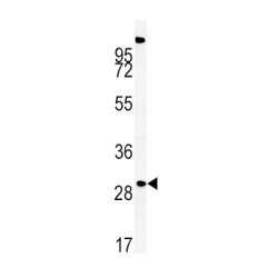 Probable Palmitoyltransferase ZDHHC21 (ZDHHC21) Antibody