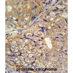 Kelch-Like Protein 9 (KLHL9) Antibody