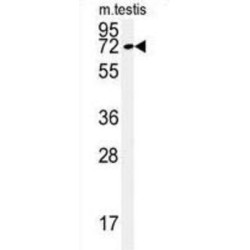 Kelch-Like Protein 9 (KLHL9) Antibody