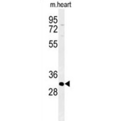 ATPase, H+/K+ Exchanging Beta Polypeptide (ATP4B) Antibody