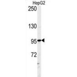 Ataxin-2-Like Protein (ATXN2L) Antibody