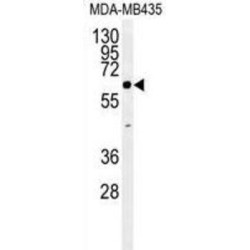 ERO1-Like Beta (S. Cerevisiae) (ERO1LB) Antibody