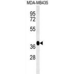 F-Box And Leucine-Rich Repeat Protein 14 (FBXL14) Antibody