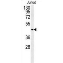 Free Fatty Acid Receptor 3 (FFAR3) Antibody