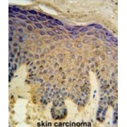 Chromosome 14 Open Reading Frame 94 (HAUS4) Antibody