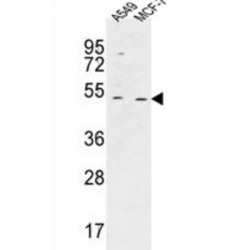 Chromosome 14 Open Reading Frame 94 (HAUS4) Antibody