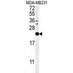 Interleukin-1 Family Member 6 (IL1F6) Antibody
