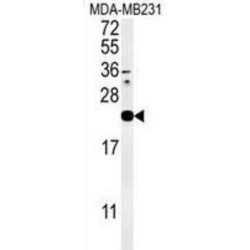 Interleukin-1 Family Member 6 (IL1F6) Antibody