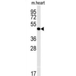 Interleukin 5 Receptor alpha (IL5RA) Antibody