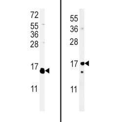 Interleukin 4 (IL4) Antibody