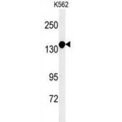 Myotubularin-Related Protein 15 (MTMRF) Antibody