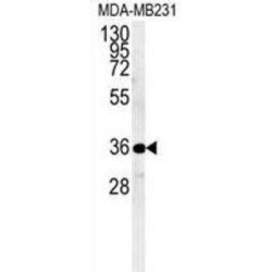 Myozenin 1 (MYOZ1) Antibody