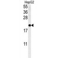 SFT2 Domain Containing 3 (SFT2D3) Antibody