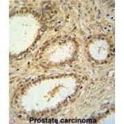 U5 Small Nuclear Ribonucleoprotein 40 kDa Protein (SNRNP40) Antibody