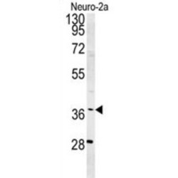 U5 Small Nuclear Ribonucleoprotein 40 kDa Protein (SNRNP40) Antibody