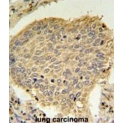 Trafficking Protein Particle Complex Subunit 6A (TPC6A) Antibody