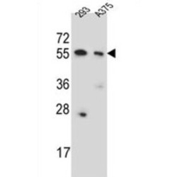 Copine-8 (CPNE8) Antibody