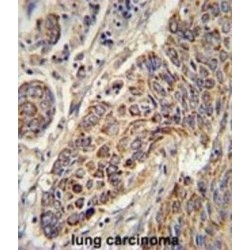 Cytochrome C1 (CYC1) Antibody