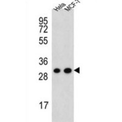 Cytochrome C1 (CYC1) Antibody