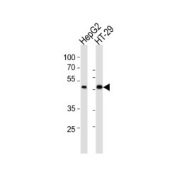 Mothers Against Decapentaplegic Homolog 6 (SMAD6) Antibody