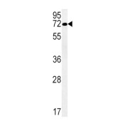 Solute Carrier Family 19 Member 3 (SLC19A3) Antibody