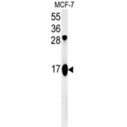 ATP Synthase Subunit F, Mitochondrial (ATP5J2) Antibody