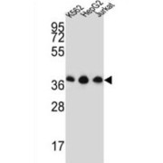 Heterogeneous Nuclear Ribonucleoprotein D-Like (HNRNPDL) Antibody