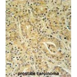 Ubiquitin-Associated Domain-Containing Protein 1 (UBAC1) Antibody