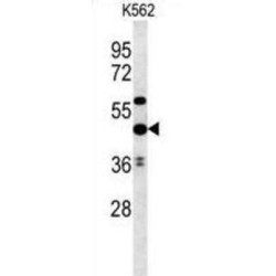 Ubiquitin-Associated Domain-Containing Protein 1 (UBAC1) Antibody